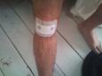 pleister lekt iets